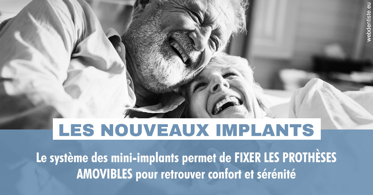 https://www.cabinet-dentaire-les-marronniers-ronchin.fr/Les nouveaux implants 2
