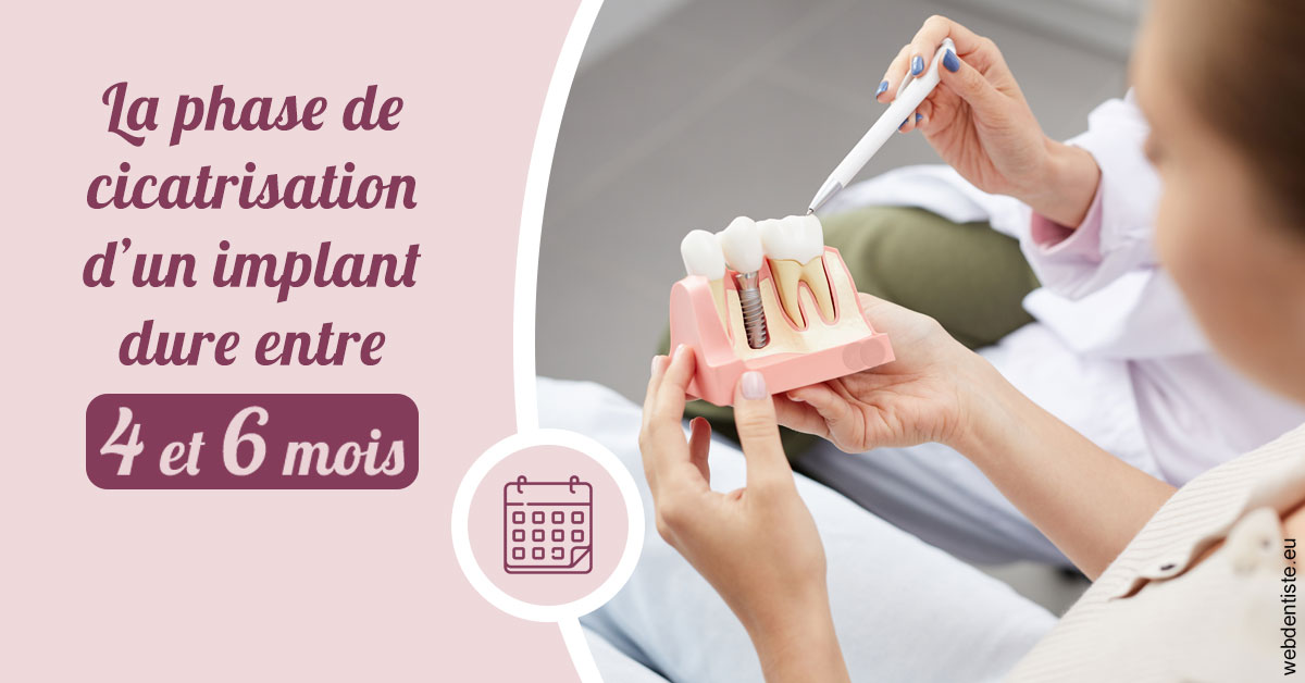 https://www.cabinet-dentaire-les-marronniers-ronchin.fr/Cicatrisation implant 2