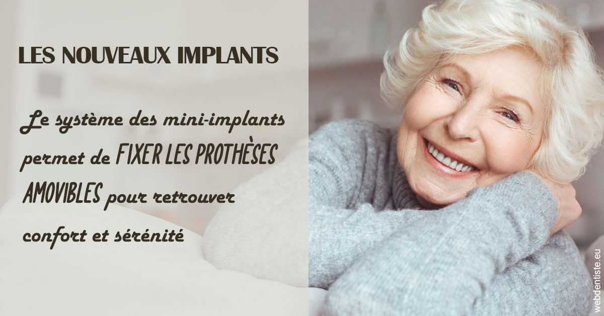 https://www.cabinet-dentaire-les-marronniers-ronchin.fr/Les nouveaux implants 1