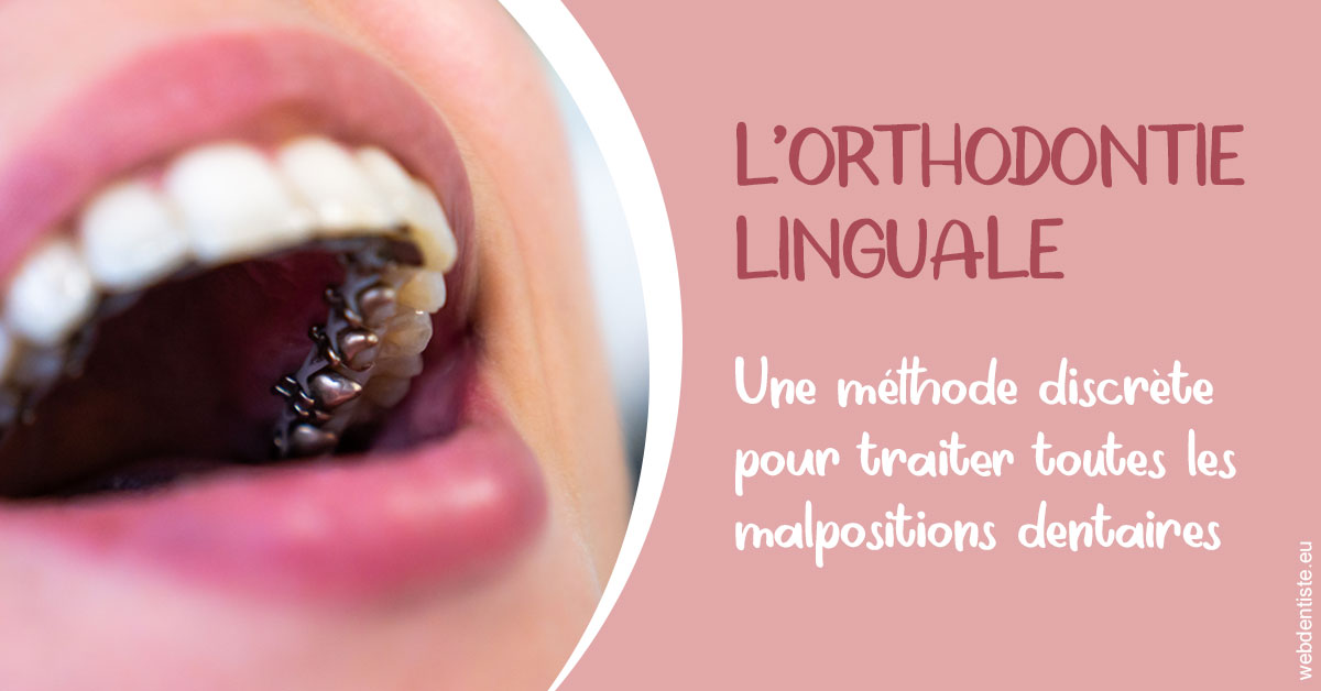 https://www.cabinet-dentaire-les-marronniers-ronchin.fr/L'orthodontie linguale 2