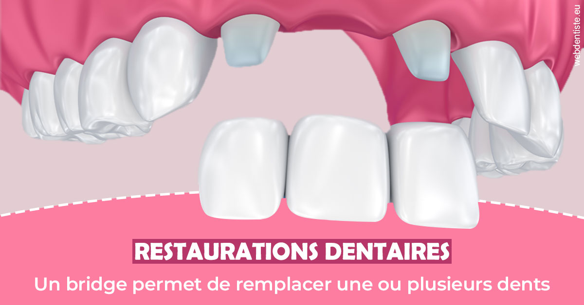 https://www.cabinet-dentaire-les-marronniers-ronchin.fr/Bridge remplacer dents 2
