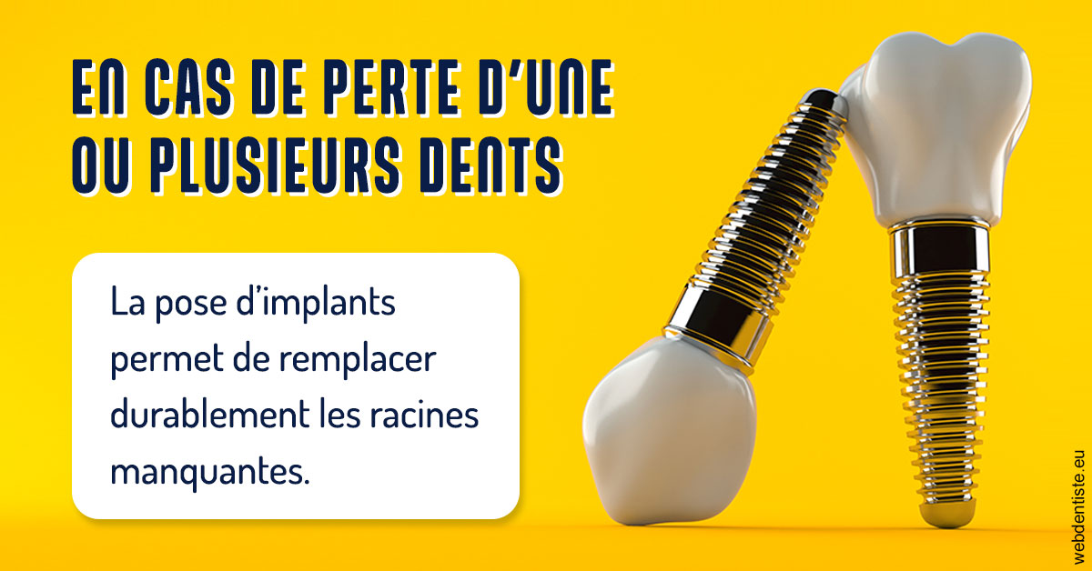 https://www.cabinet-dentaire-les-marronniers-ronchin.fr/2024 T1 - Implants 02