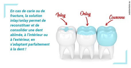 https://www.cabinet-dentaire-les-marronniers-ronchin.fr/L'INLAY ou l'ONLAY