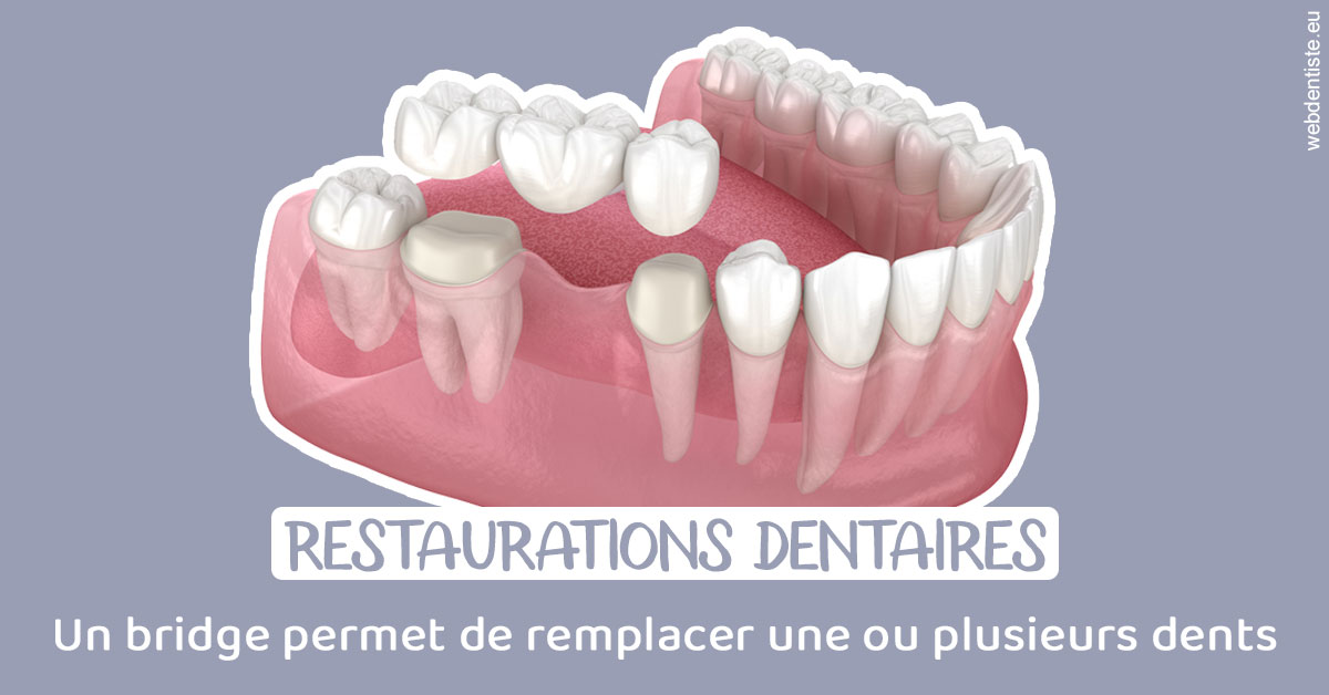 https://www.cabinet-dentaire-les-marronniers-ronchin.fr/Bridge remplacer dents 1