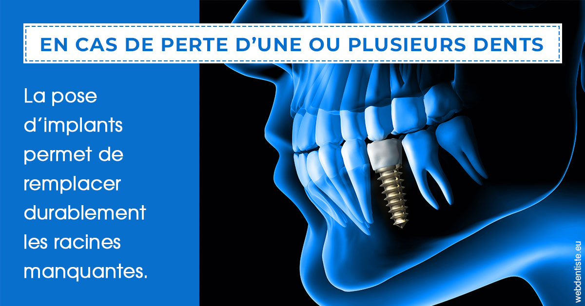 https://www.cabinet-dentaire-les-marronniers-ronchin.fr/2024 T1 - Implants 01