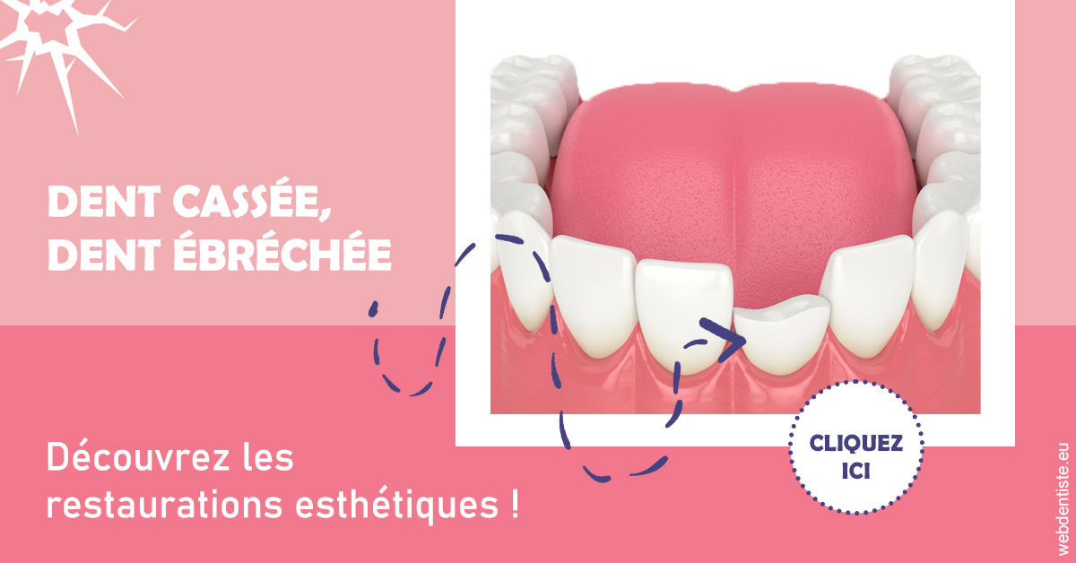 https://www.cabinet-dentaire-les-marronniers-ronchin.fr/Dent cassée ébréchée 1