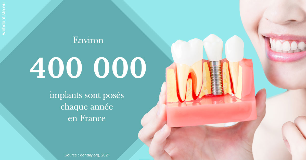 https://www.cabinet-dentaire-les-marronniers-ronchin.fr/Pose d'implants en France 2