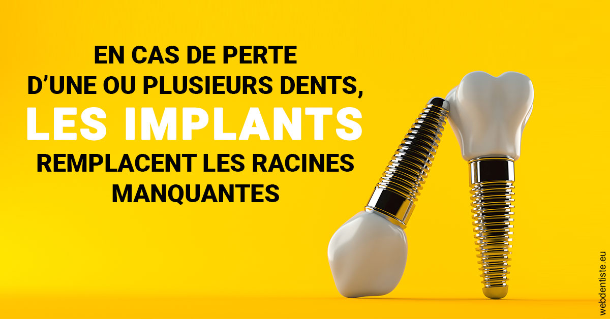https://www.cabinet-dentaire-les-marronniers-ronchin.fr/Les implants 2
