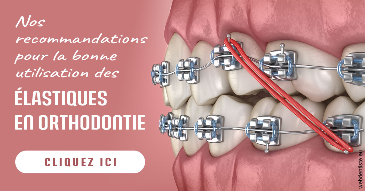 https://www.cabinet-dentaire-les-marronniers-ronchin.fr/Elastiques orthodontie 2